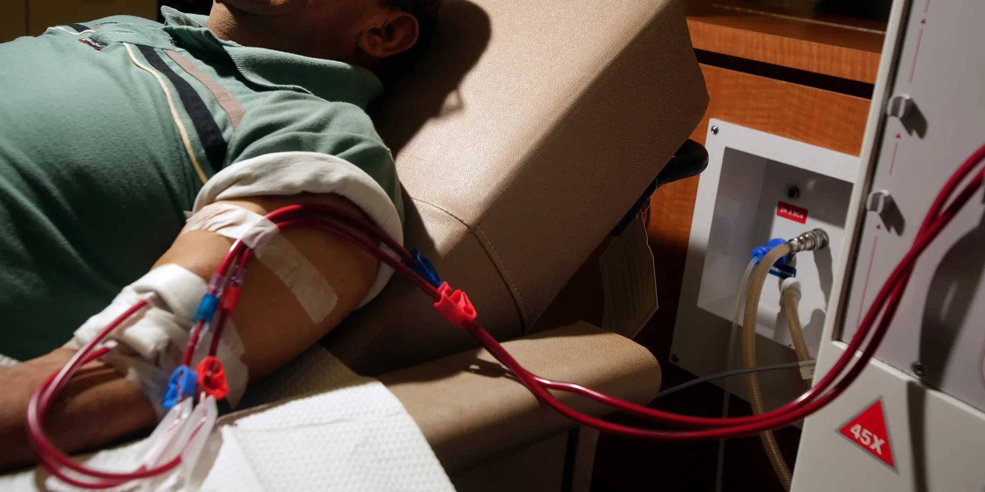 Hemodialysis
